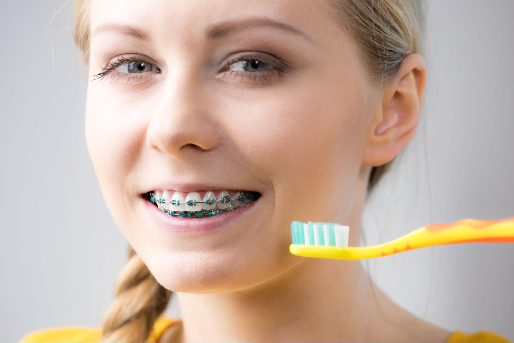 Brushing Tips for Braces